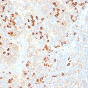 Formalin-fixed, paraffin-embedded human Tonsil stained with Plasma Cell Marker Monoclonal Antibody (SPM31).
