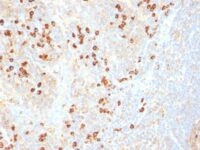 Formalin-fixed, paraffin-embedded human Tonsil stained with Plasma Cell Marker Monoclonal Antibody (SPM31).