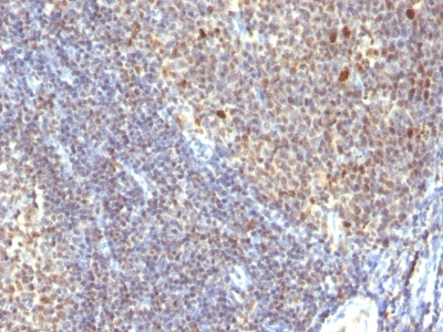 Formalin-fixed, paraffin-embedded human Tonsil stained with IPO38 Monoclonal Antibody (SPM26).