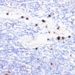 Formalin-fixed, paraffin-embedded human Tonsil stained with Myeloid Specific Monoclonal Antibody (BM-2).