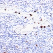 Formalin-fixed, paraffin-embedded human Tonsil stained with Myeloid Specific Monoclonal Antibody (BM-2).