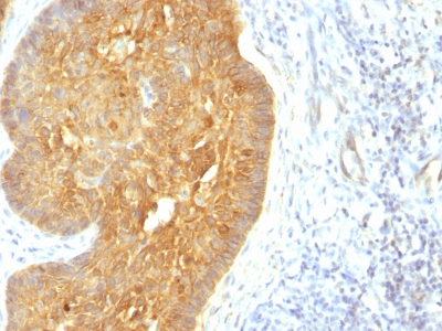 Formalin-fixed, paraffin-embedded human Skin stained with Cytokeratin, LMW Monoclonal Antibody (KRTL/1377).