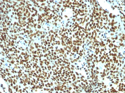 Formalin-fixed, paraffin-embedded human Tonsil stained with Pan-Nuclear Ag Monoclonal Antibody (NM16).