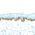 Western Blot of A431 Cells using Cytokeratin, LMW Monoclonal Antibody (AE-1).