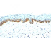 Western Blot of A431 Cells using Cytokeratin, LMW Monoclonal Antibody (AE-1).