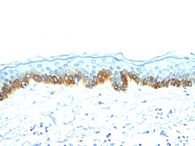 Western Blot of A431 Cells using Cytokeratin, LMW Monoclonal Antibody (AE-1).