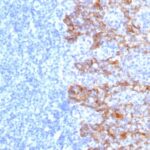 Formalin-fixed, paraffin-embedded human Tonsil stained with Cytokeratin, LMW Monoclonal Antibody (SPM115)