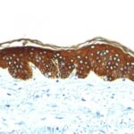 Formalin-fixed, paraffin-embedded human Skin stained with Cytokeratin, HMW Monoclonal Antibody (AE-3).