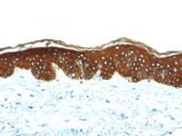 Formalin-fixed, paraffin-embedded human Skin stained with Cytokeratin, HMW Monoclonal Antibody (AE-3).