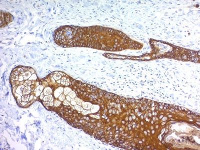 Formalin paraffin Rat Stomach stained with Cytokeratin, HMW Monoclonal Antibody (KRTH/176).