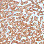 200 ul of predilute SingleStep™ Poly-HRP conjugated goat anti-mouse secondary antibody was incubated 30 minutes following staining of human liver samples with a hepatocyte specific mitochondrial marker (antibody catalog number msm4-966)  Excellent signal intensity is observed in the absence of any additional amplification step.