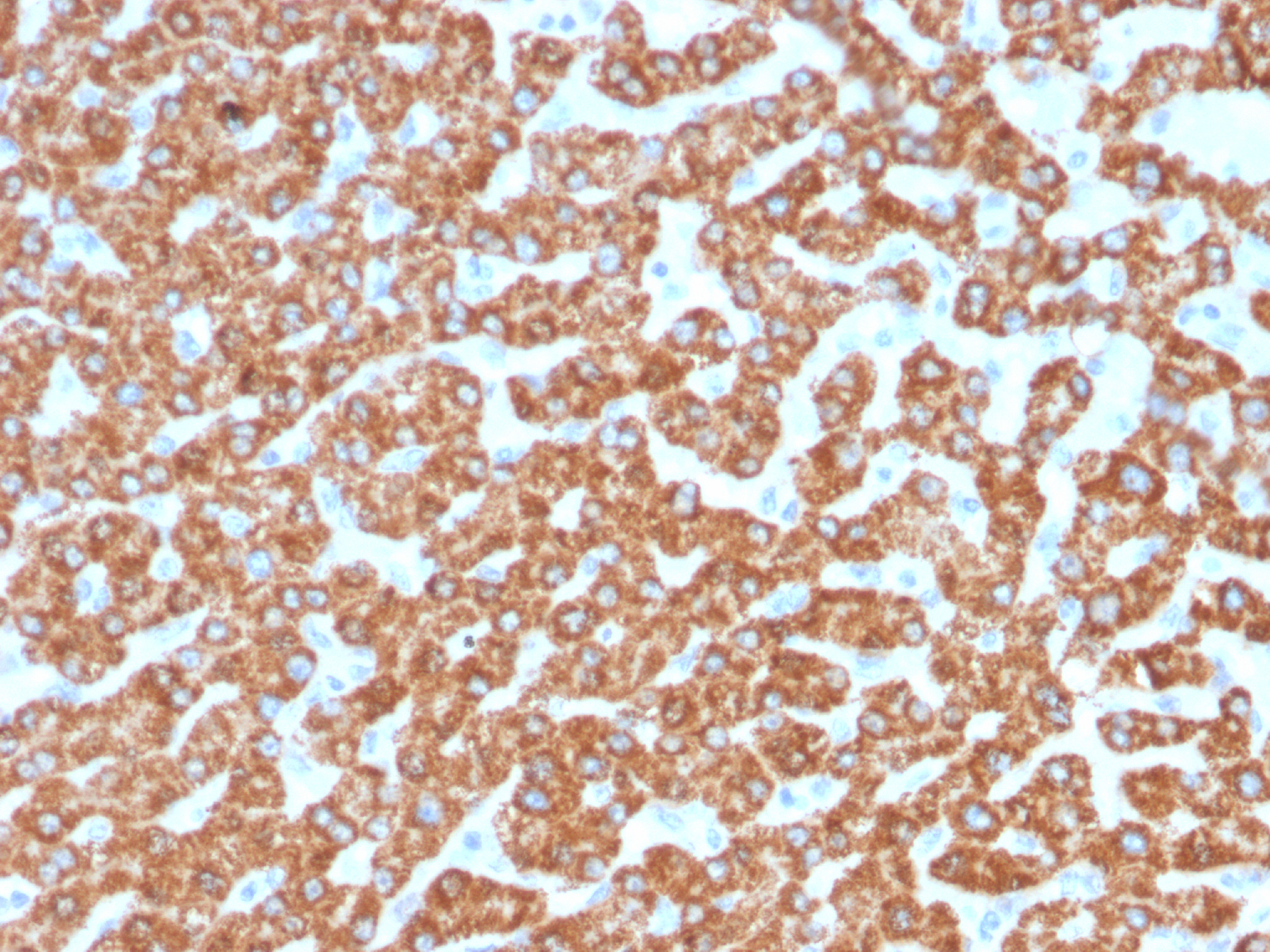 200 ul of predilute SingleStep™ Poly-HRP conjugated goat anti-mouse secondary antibody was incubated 30 minutes following staining of human liver samples with a hepatocyte specific mitochondrial marker (antibody catalog number msm4-966)  Excellent signal intensity is observed in the absence of any additional amplification step.