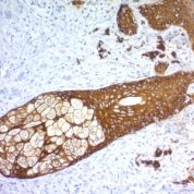 Formalin-fixed, paraffin-embedded human Skin stained with Cytokeratin, HMW Recombinant Rabbit Monoclonal Antibody (KRTH/1576R).