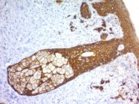 Formalin-fixed, paraffin-embedded human Skin stained with Cytokeratin, HMW Recombinant Rabbit Monoclonal Antibody (KRTH/1576R).