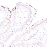 Formalin-fixed, paraffin-embedded human Stomach stained with Helicobacter pylori Rabbit Polyclonal Antibody.