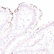 Formalin-fixed, paraffin-embedded human Stomach stained with Helicobacter pylori Rabbit Polyclonal Antibody.
