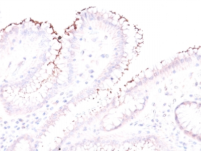 Formalin-fixed, paraffin-embedded human Stomach stained with Helicobacter pylori Rabbit Polyclonal Antibody.