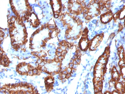 Formalin-fixed, paraffin-embedded Mouse Kidney Stained with  KSP-Cadherin Rabbit Monoclonal Antibody (CDH16/1532R)