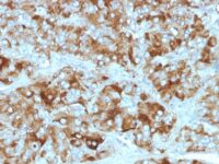 Formalin-fixed, paraffin-embedded Adrenal Gland stained with Chromogranin A Monoclonal Antibody (CGA/413+ CHGA/777+ CHGA/798)