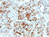 Formalin-fixed, paraffin-embedded human Adrenal Gland stained with Chromogranin A Monoclonal Antibody (CHGA/765)