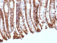 Formalin-fixed, paraffin-embedded Mouse Colon stained with Beta-Catenin (p12) Monoclonal Antibody (CTNNB1/158).