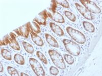 Formalin-fixed, paraffin-embedded Rat Colon stained with Beta-Catenin (p12) Monoclonal Antibody (CTNNB1/159).