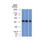Western Blot of Y79, HeLa and HepG2 Cell Lysate using NSE, gamma Monoclonal Antibody (ENO2/1375).
