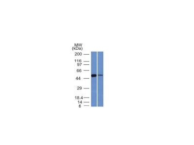 Western Blot of K562 and Lung Lysate using ALDH1A1 Monoclonal Antibody (ALDH1A1/1381).
