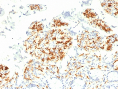 Formalin-fixed, paraffin-embedded human Small Intestine stained with CD29 Monoclonal Antibody (C29/1781).