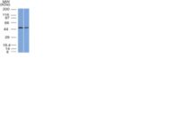 Western Blot Analysis (A) MCF-7 (B) PC3 Cell lysate Using FOXA1 Monoclonal Antibody (FOXA1/1512)