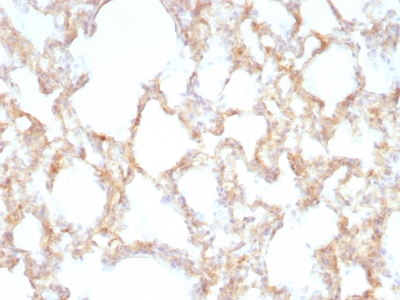 Formalin-fixed, paraffin-embedded Rat Lung stained with Cytokeratin 7 Monoclonal Antibody (KRT7/1198)