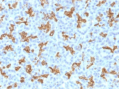 Formalin-fixed, paraffin-embedded human Pancreas stained with Cytokeratin 19 Monoclonal Antibody (KRT19/8)