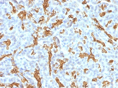 Formalin-fixed, paraffin-embedded human Pancreas stained with Cytokeratin 19 Monoclonal Antibody (KRT19/799 + KRT19/8)