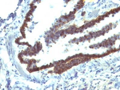 Formalin-fixed, paraffin-embedded Rat Lung stained with Epcam Monoclonal Antibody (EGP4/111).