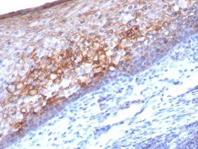 Formalin-fixed, paraffin-embedded human Tonsil stained with MCAM Monoclonal Antibody (MCAM/111)