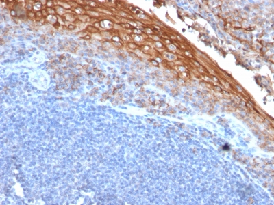 Formalin-fixed, paraffin-embedded human Tonsil stained with MUC18 Monoclonal Antibody (MUC18/113)