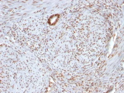Formalin-fixed, paraffin-embedded human Uterus stained with Nucleolin Monoclonal Antibody (364-5 + NCL/92).