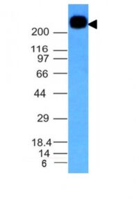 Western Blot Analysis of Daudi Cell Lysate using CD45RB Monoclonal Antibody (PTPRC/1132).