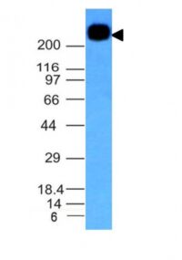 Western Blot Analysis of Daudi Cell Lysate Using CD45RB Monoclonal Antibody (PTPRC/1147).