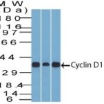 Flow Cytometry of human Cyclin D1 on MCF-7 Cells. Black: Cells alone; Green: Isotype Control; Red: PE-labeled Cyclin D1 Monoclonal Antibody (SPM587).