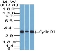 Flow Cytometry of human Cyclin D1 on MCF-7 Cells. Black: Cells alone; Green: Isotype Control; Red: PE-labeled Cyclin D1 Monoclonal Antibody (SPM587).