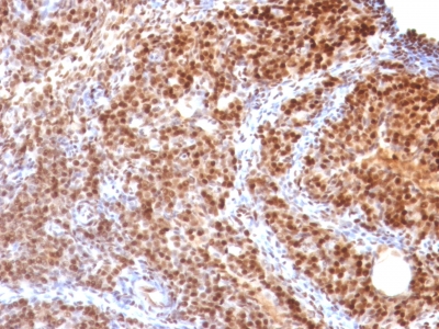 Formalin-fixed, paraffin-embedded Rat Ovary stained with SUMO-2 Monoclonal Antibody (SUMO2/1199)