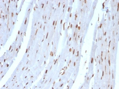 Formalin-fixed, paraffin-embedded Rat Heart stained with SUMO-2 Monoclonal Antibody (SUMO2/1199)