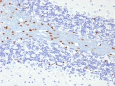Formalin-fixed, paraffin-embedded Mouse Brain SOX1 MAb (SOX1/991).