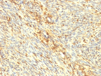 Formalin-fixed, paraffin-embedded human Uterus stained with Transglutaminase II Monoclonal Antibody (TGM2/419)