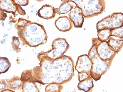 Formalin-fixed, paraffin-embedded human Placenta stained with Thrombomodulin/CD141 Monoclonal Antibody (THBD/1591).
