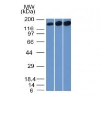 Western Blot of HepG2, HeLa and 3T3 Cell Lysate using Topo II alpha, Monoclonal Antibody (TOP2A/1361).