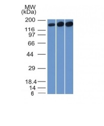 Western Blot of HepG2, HeLa and 3T3 Cell Lysate using Topo II alpha, Monoclonal Antibody (TOP2A/1361).
