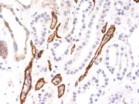 Formalin-fixed, paraffin-embedded human Kidney Transplant stained with Complement 4d Monoclonal Antibody (C4D24).