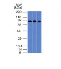 Western Blot of A549, HepG2 & HCT116 Cell Lysates with Villin Monoclonal Antibody (VIL1/1325).